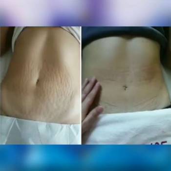 Beautyshapes, Днепр Фото - 6