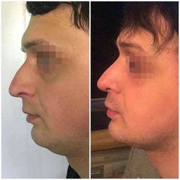 Таир, Запоріжжя Фото - 5