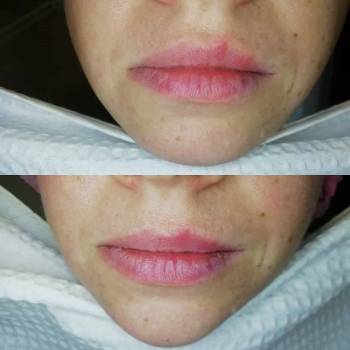 Фото с портфолио O-la-la