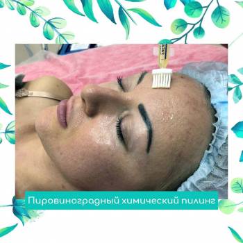 Platinum Laser, Киев Фото - 7