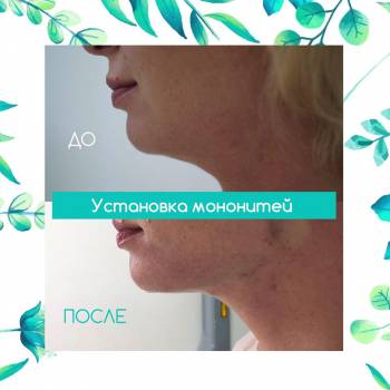 Platinum Laser, Киев Фото - 3