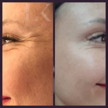 Любовь Каймашникова, Одеса Фото - 13