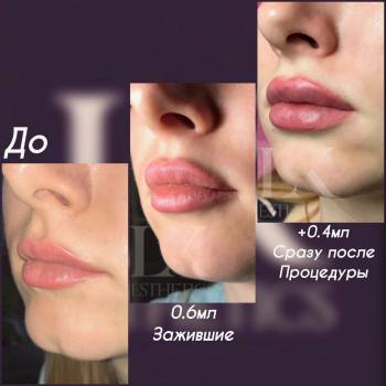 Любовь Каймашникова, Одеса Фото - 14