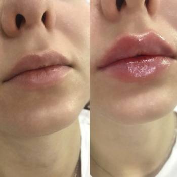 Фото с портфолио Марина Бондаренко Романовская