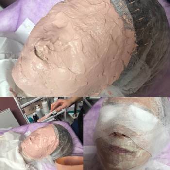 авторская процедура "мгновенный лифтинг"