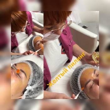 желтый пилинг