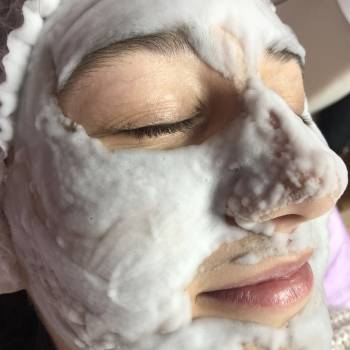 карбокситерапия