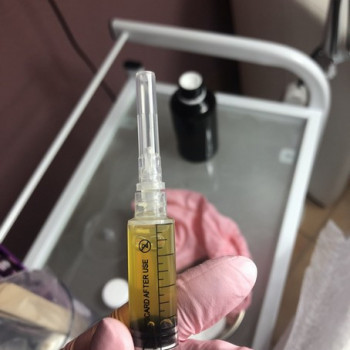 Плазмолифтинг
                    Салон краси Богиня Київ