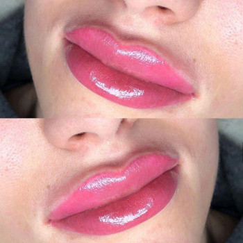 Татуаж губ
                    Косметологический центр The Legend Киев