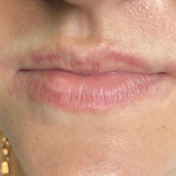 Татуаж губ
                    Косметологический центр The Legend Киев