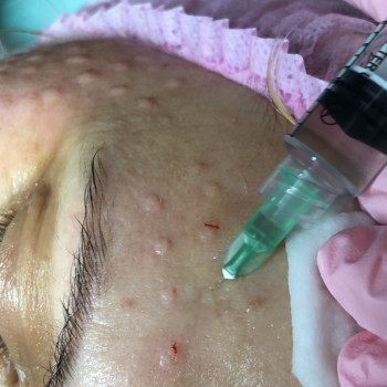 Фото с портфолио Аліна Скороход