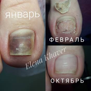 Елена Олеговна Хавер, Черкассы Фото - 26