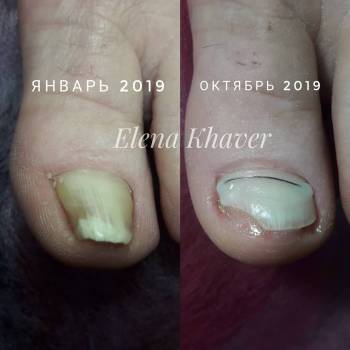 Елена Олеговна Хавер, Черкассы Фото - 34