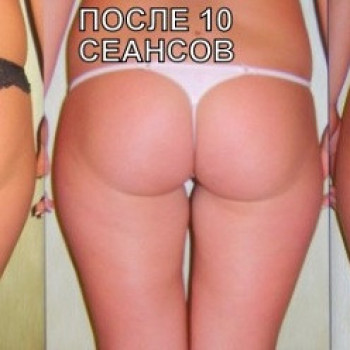 Массаж медовый
                    Косметолог Дарья Маріуполь