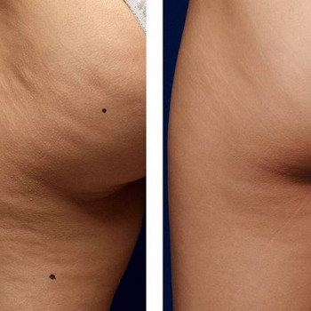 Массаж медовый
                    Косметолог Дарья Маріуполь