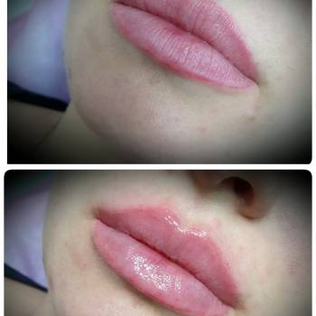 Наталья Еременко, Суми Фото - 23