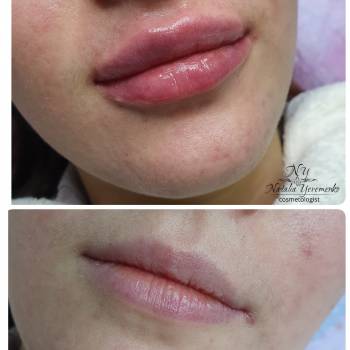 Наталья Еременко, Суми Фото - 24