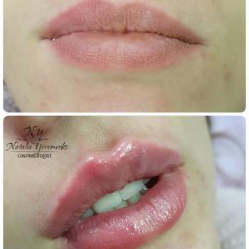 Наталья Еременко, Суми Фото - 3