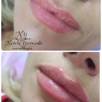 Наталья Еременко, Суми Фото - 5