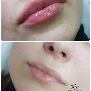 Наталья Еременко, Суми Фото - 6