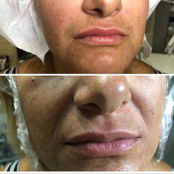 Марина Мачтакова, Маріуполь Фото - 6