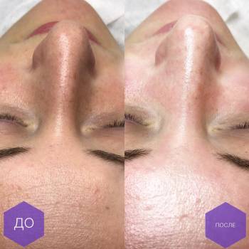 Фото с портфолио Дарья Калинина 