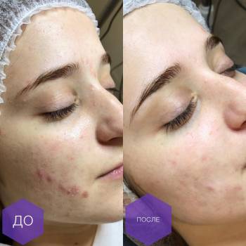 Фото с портфолио Дарья Калинина 