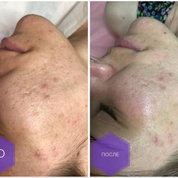 Фото с портфолио Дарья Калинина 