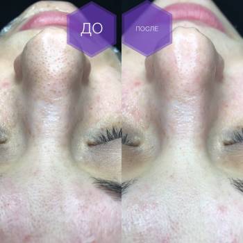 Фото с портфолио Дарья Калинина 