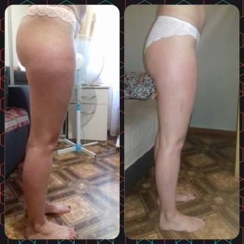 1-10 сеанс антицеллюлитный массаж 