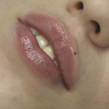 Вадим Васьковський, Житомир Фото - 16