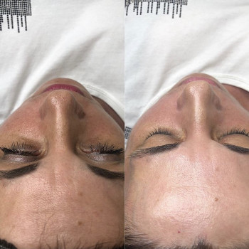 Пилинг prxT-33
                    Косметолог Анна Гетьман Харків