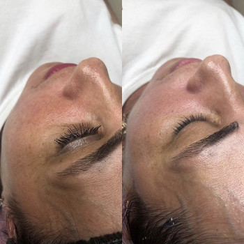 Пилинг prxT-33
                    Косметолог Анна Гетьман Харків