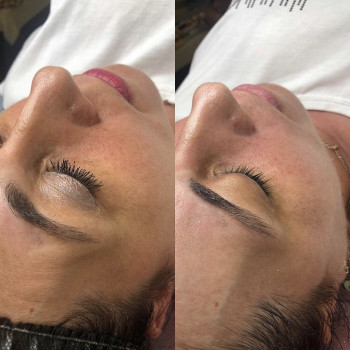 Пилинг prxT-33
                    Косметолог Анна Гетьман Харків