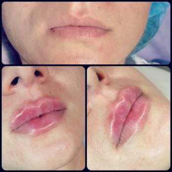 Елена Карловская , Маріуполь Фото - 6