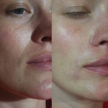 Елена Карловская , Маріуполь Фото - 7