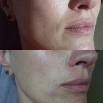 Елена Карловская , Маріуполь Фото - 8