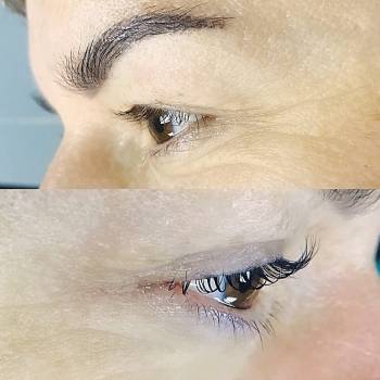 Pro Skin, Чернігів Фото - 4