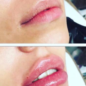 Фото с портфолио ZenGo