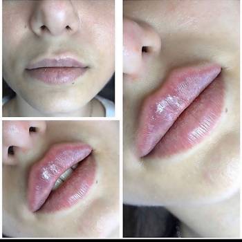 Фото с портфолио BE STYLE