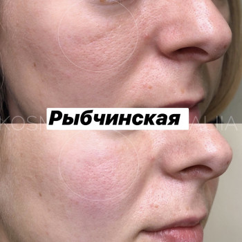 полинуклеотиды