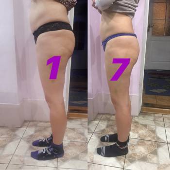 Фото из портфолио мастера Дарья (массажист, Мелитополь)