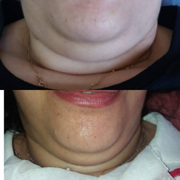 Ліполітики
                    Косметолог-ін'єкціоніст Елена Львів