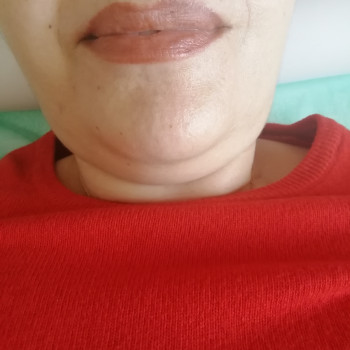 Ліполітики
                    Косметолог-ін'єкціоніст Елена Львів