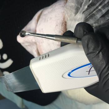 Комбінована чистка обличчя