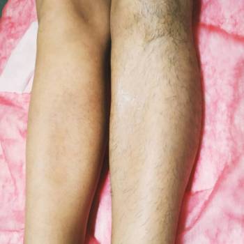 До та після