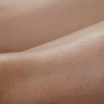 Шкіра одразу після депіляції