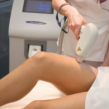 Лазерная эпиляция
                    Косметолог Юлия Киев