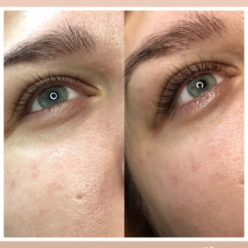 Ламинирование ресниц
                    Лешмейкер Светлана Поддубняк Київ