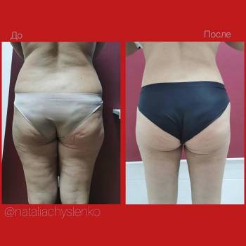 Олег Колибаба , Киев Фото - 5